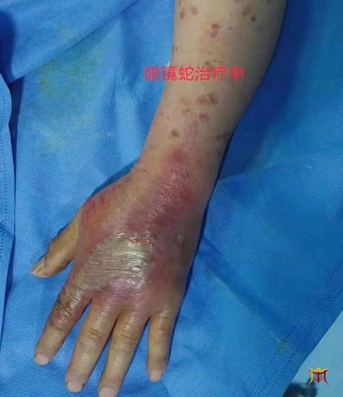 新澳正版资料大全免費和男子在湖边被蛇咬伤与男子在湖边被蛇咬伤视频